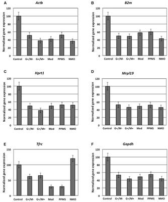 Bioenergetic Failure in Rat Oligodendrocyte Progenitor Cells Treated with Cerebrospinal Fluid Derived from Multiple Sclerosis Patients